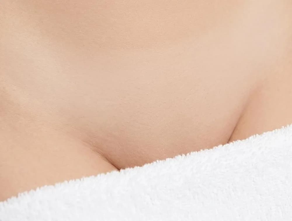 Strefa bikini po serii zabiegów depilacji laserowej – gładka skóra bez wrastających włosków