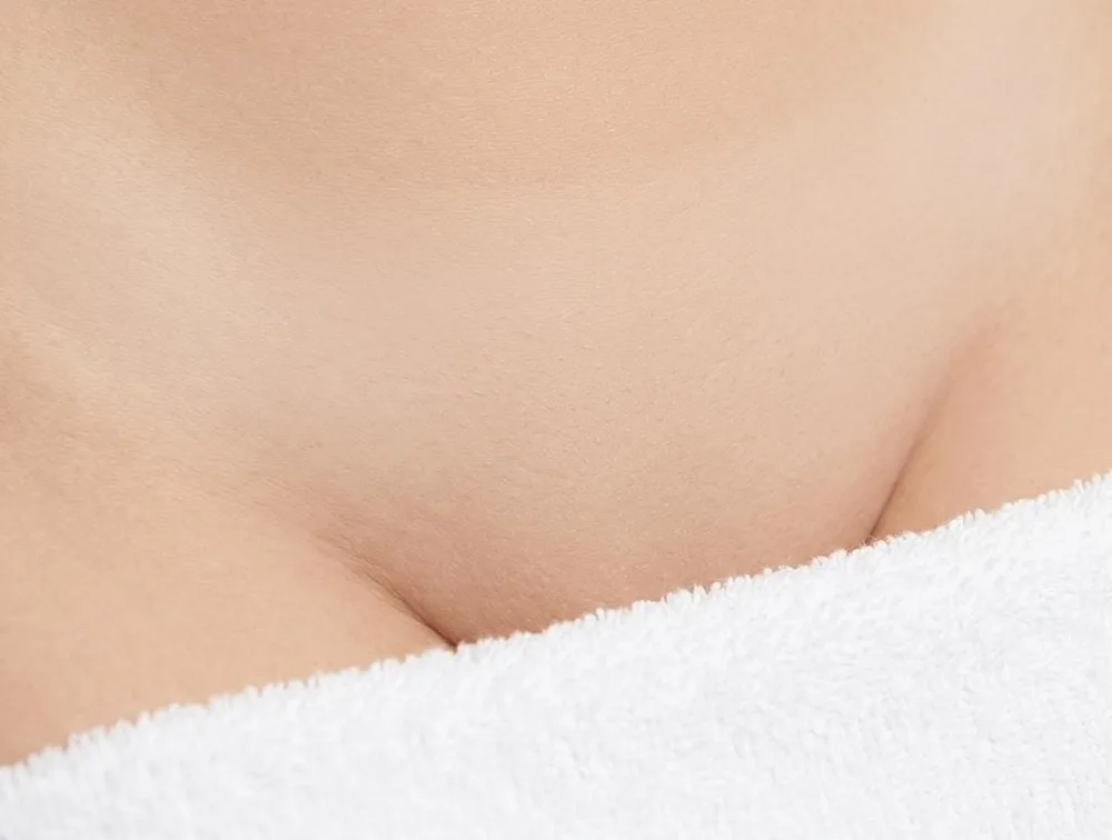 Strefa bikini po serii zabiegów depilacji laserowej – gładka skóra
